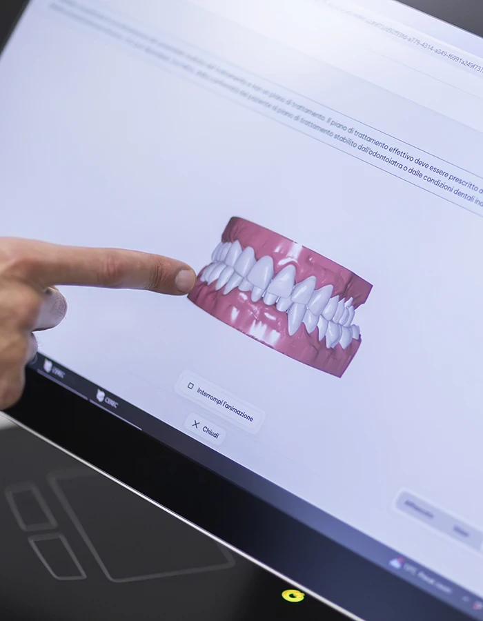 dentista esegue un intervento con tecnologia avanzata