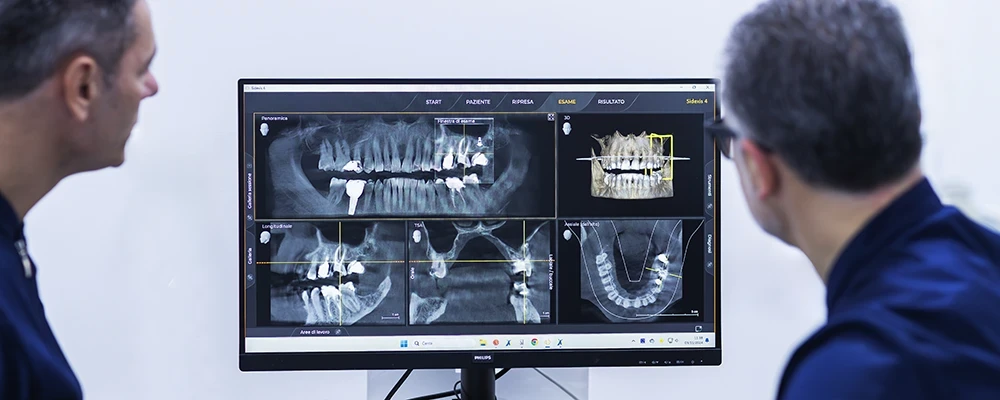Strumenti Radiografici Digitali