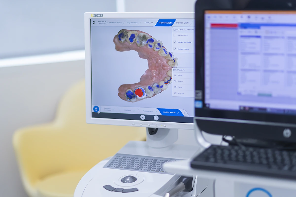 Scanner 
                dentale che ricostruisce un'immagine 3D dell'arcata dentale, mostrando dettagli anatomici e strutturali.