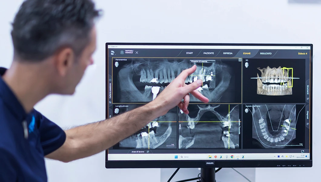Odontoiatri analizzano radiografie
                            dentali per pianificazione di un trattamento endodontico